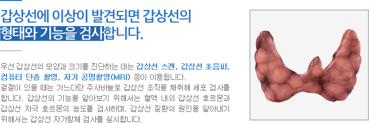 우리 몸에는 호르몬을 만드는 기관이 있는데 이를 내분비 기관 이라 부릅니다. 이러한 내분비 기관으로는 내분비 기관들을 중추적으로 조절하는 뇌하수체, 혈당을 조절하는 췌장, 스트레스를 조절하는 부신 등이 있습니다. 갑상선은 갑상선 호르몬을 만들어 필요할 때마다 혈액으로 내보내는 일을 합니다.
정상 갑상선의 위치는 목 앞부분에 돌출되어 있는 목젖(갑상선 연골)의 바로 아래에 위치합니다. 갑상선의 크기는 길이가 4~5cm, 너비가 1.5~2cm, 두께가 2~4cm이며 좌우에 각각 있으며 중간은 협부로 연결되어 있어 전체적으로 나비 모양입니다.